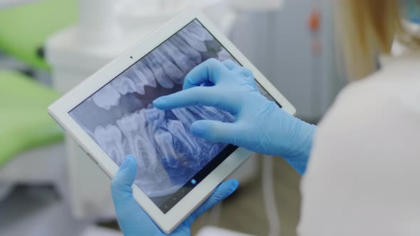 X-ray of the Teeth on a Portable Device alt