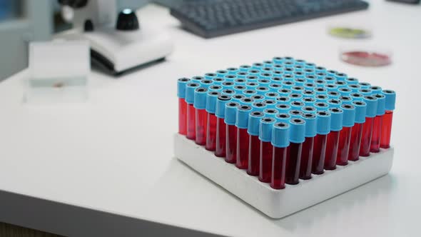 Close Up of Vacutainers Tray with Blood on Desk alt
