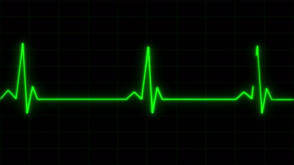 Concept 8-E1 Realistic Heart Pulse Monitor Animation alt