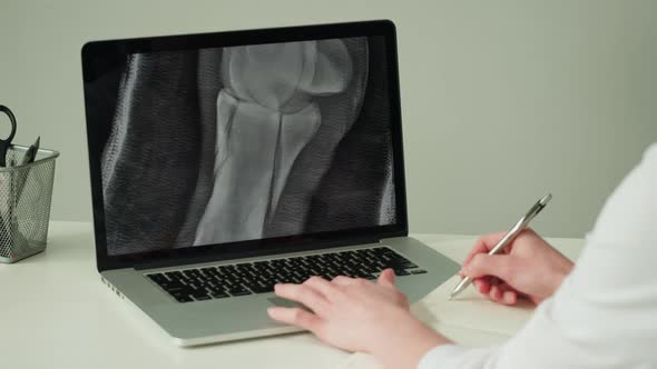 Doctor Veterinarian Examining Horse Leg Skeleton Roentgen on Laptop Monitor alt