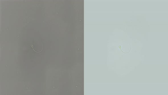 Human Sperm Under a Microscope (Spermatozoa), Consists of Sperm and Seminal Fluid alt