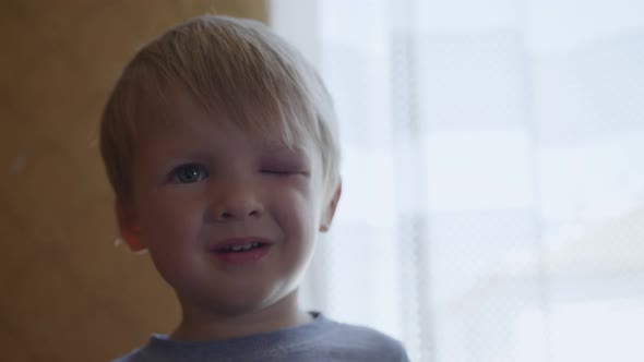 Male Child with Edema and Bruise in Eye Received From a Blow or Fall During Dangerous Games alt