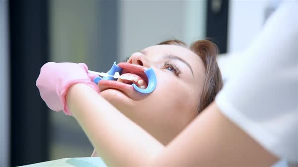 Dentist Selects Shade Of Patient Teeth. alt