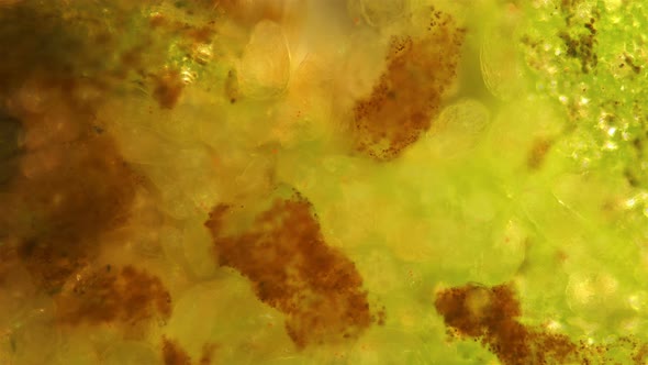 Colony Rotifers Philodina Sp. Under a Microscope, Family Philodinidae, Class Bdelloidea, Mainly alt