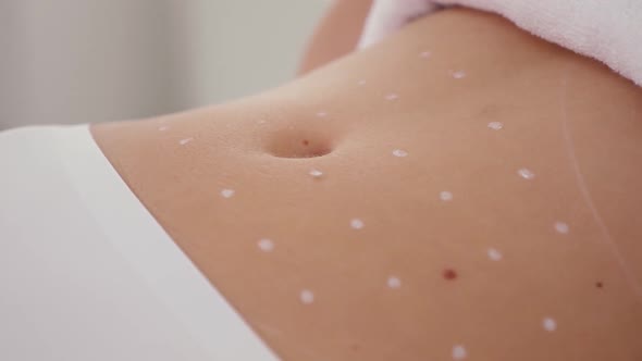 Female Belly with Marks alt