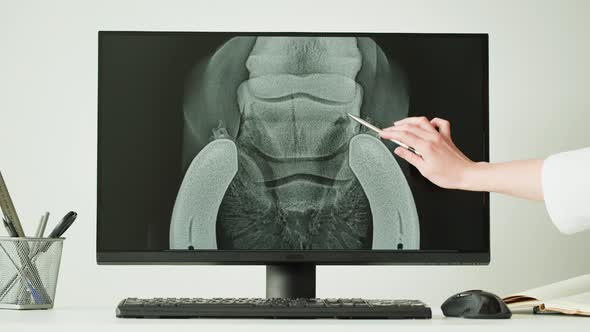 Doctor Veterinarian Examining Horse Leg Skeleton Roentgen on Computer Monitor alt