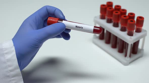 Malaria Test, Doctor Showing Blood Sample in Tube, Lab Research, Health Checkup alt