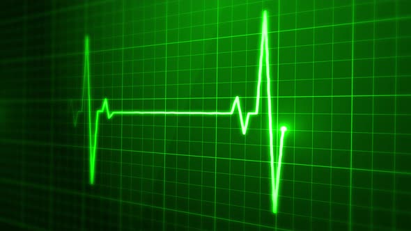 EKG Pulse Beat Green Loop