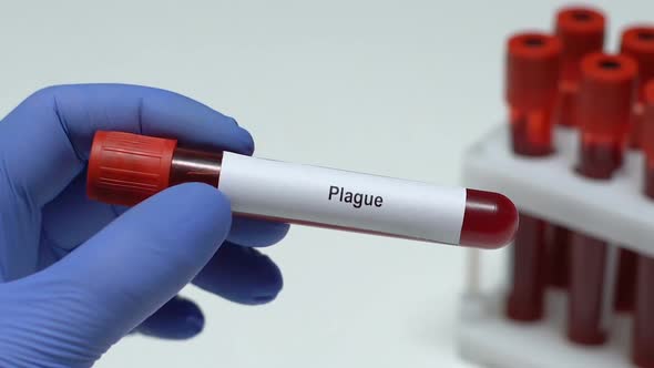 Plague, Doctor Holding Blood Sample in Tube Close-Up, Health Examination alt