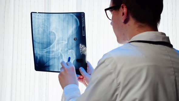 Doctor Examining Pelvis Hip Xray Closeup alt