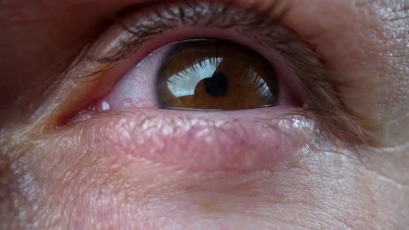 Extreme Closeup Eyes with Red Whites After Insomnia Long Work at the Computer alt