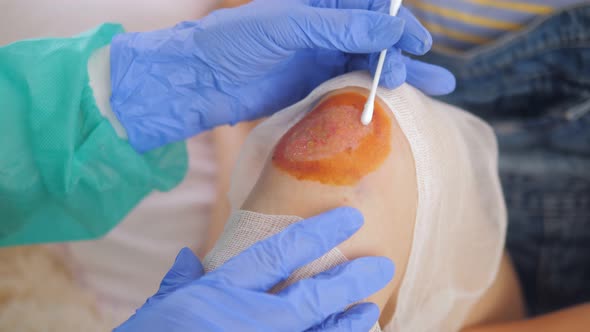 Closeup a Doctor in Medical Sterile Gloves Cotton Swab Treated with Antiseptic Bleeding Wound on the alt