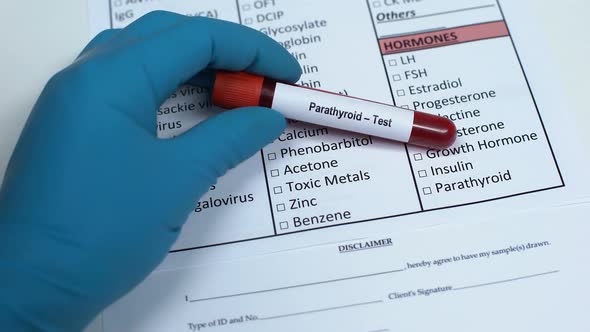 Parathyroid, Doctor Checking Hormone in Lab Blank, Showing Blood Sample in Tube alt