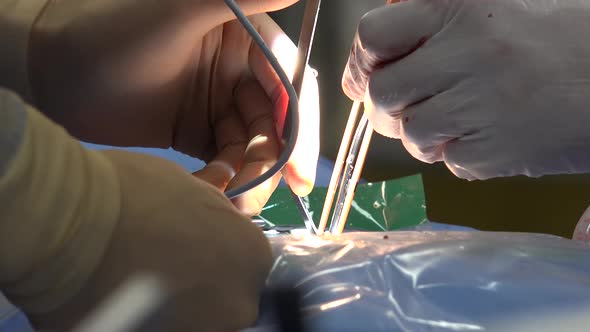 Back Surgery Or Minimally Invasive Spine Surgery 