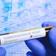 Coronavirus blood test in hospital laboratory - VideoHive Item for Sale