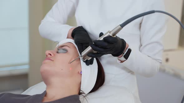 Using YAG Laser for Facial Skin Therapy at Cosmetology Clinic alt