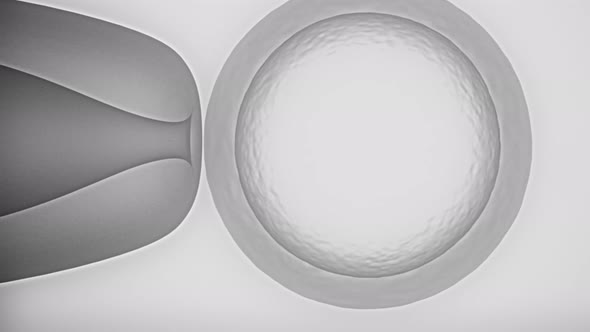 In Vitro Fertilization.Needle Puncture Of Human Egg And Sperm Injection alt