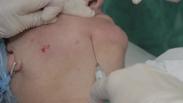 The Doctor Gives a Botox Injection Into the Patient's Neck