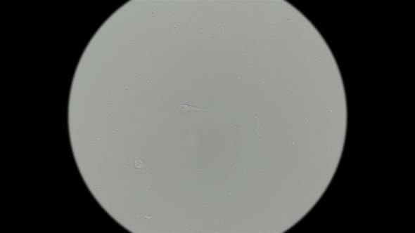 Human Sperm Under a Microscope (Spermatozoa), Consists of Sperm and Seminal Fluid alt