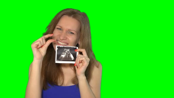 Pregnant Woman Is Holding Sonogram Looking at Camera and Smiling