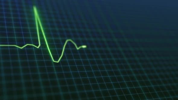 Heartbeat Display Monitor Ekg Motion Graphics Videohive