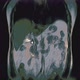 Bulk Multicolored CT Scan of the Abdomen - VideoHive Item for Sale