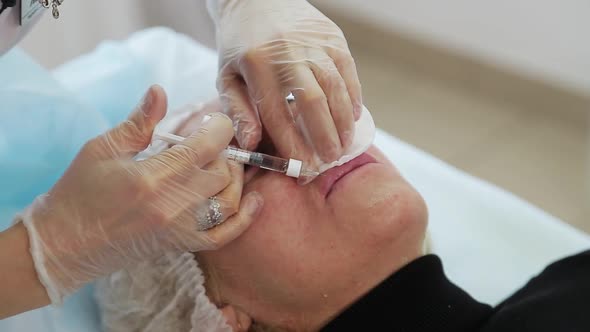 Closeup of Hands of Cosmetologist Making Botox Injection in Female Lips
