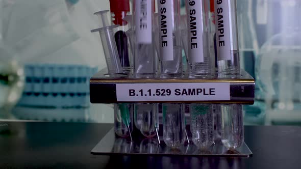 Samples named B.1.1.529 are being tested for a new Omicron variant of coronavirus in the laboratory. alt