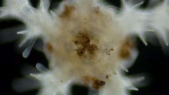 Ophiura under a microscope, class Ophiuroidea, similar to Asteroidea (sea star) alt