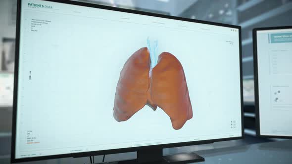 High Tech Hospital Organ Scanner Equipment Checks Human Lungs For Illness alt