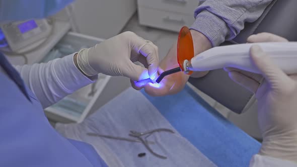 Podologist Heats the Guide Bracket with the Device on the Patient Diseased Nail