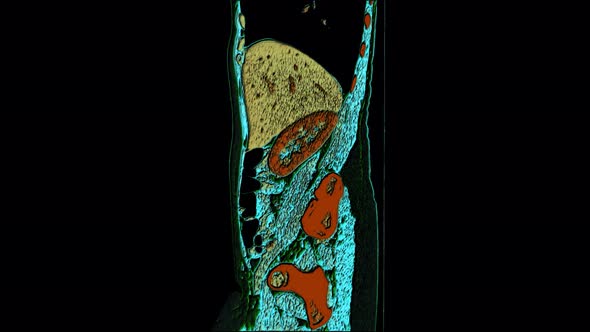 Color Contrast MRI of the Abdominal Cavity, Gastrointestinal Tract, Bladder alt