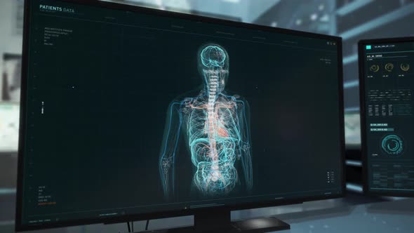Innovative Medical System For X-ray Examination Scanning Health Of Human Organs alt