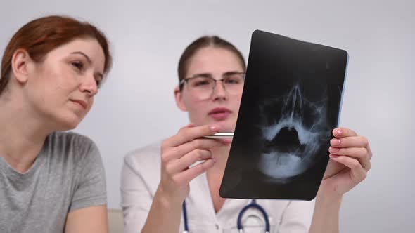 A Woman Doctor and a Patient at the Reception are Discussing an Xray of the Sinuses alt