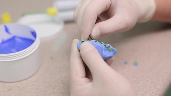 Making a Template for Temporary Veneers with A-Silicone