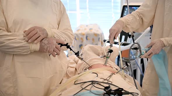 Nurse Monitors the Patient's Condition on the Monitor in Laparoscopic Appendectomy