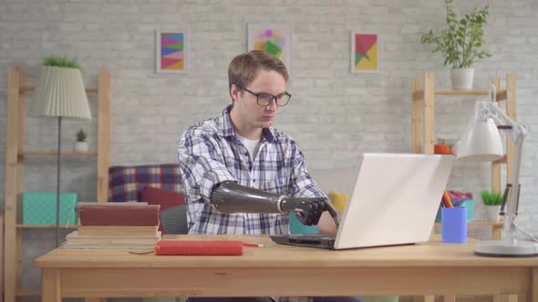 Young Man Student with Bionic Prosthetic Hand Working at a Laptop alt