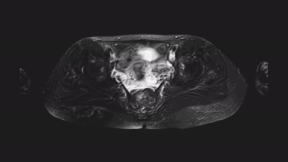 Voluminous MRI of the Female Pelvic Organs, Abdominal Cavity, Gastrointestinal Tract and Bladder alt