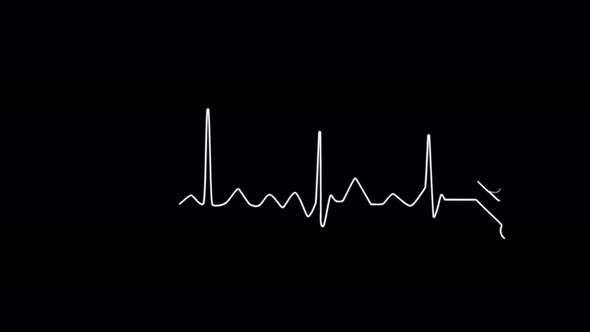 Abstract seamless line heartbeat. 4k video animation of pulse heart rhythm. Video animation alt