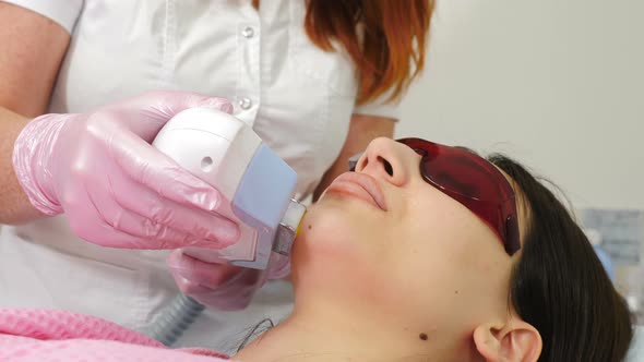 Beautician Makes Laser Hair Removal on Facial Skin Above Lips alt