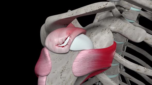 Shoulder Surgery With Corner Stitch Suture For The Rotator Cuff Tear alt