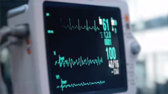 Heart Rate Monitor in Hospital Theater. Medical Vital Signs Monitor Instrument in a Hospital alt