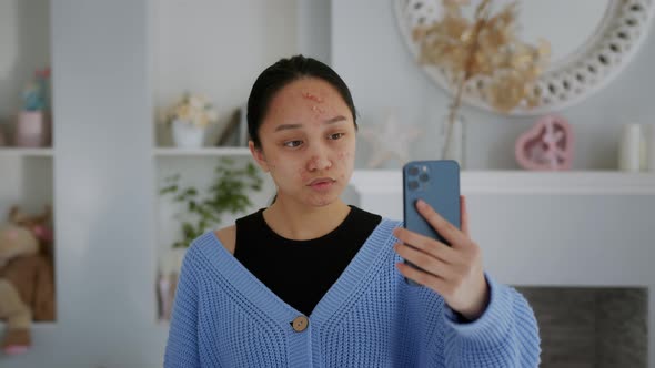Young Asian Girl with Acne Before and After Treatment Looks at the Phone and Touches the Screen