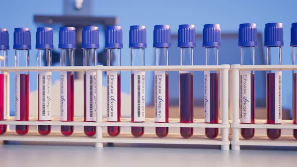 Blood samples for test in the laboratory. Positive probe. Laboratory. Lab 4k HD. alt