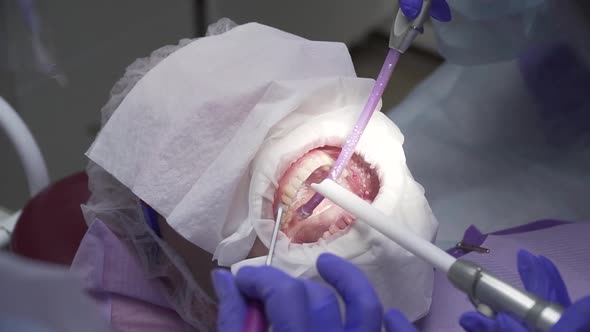 Dentist Conducts Dental Hygiene To the Patient
