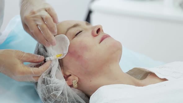 Cosmetician Gloves Making Face Lifting Injection To Area Around Eyes