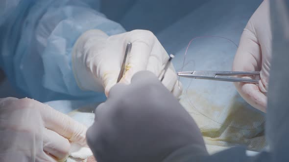 Surgeons apply stitches, Stock Footage | VideoHive