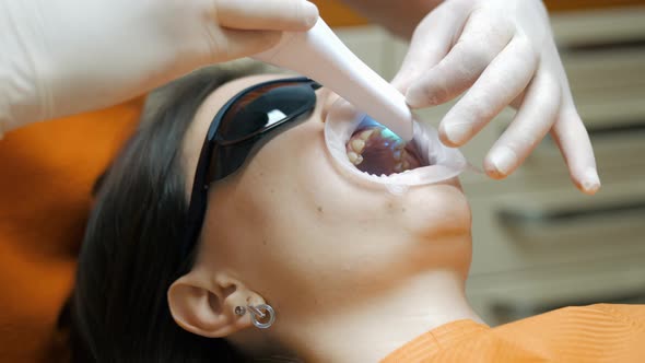 Doctor Dentist Makes a 3D Scan of the Teeth of a Female Patient for Treatment alt