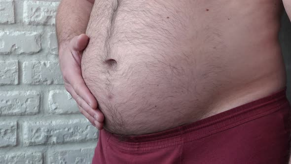 An Overweight Man Demonstrates A Big Belly With Obesity, A Man Slaps His Hand On A Fat Belly.