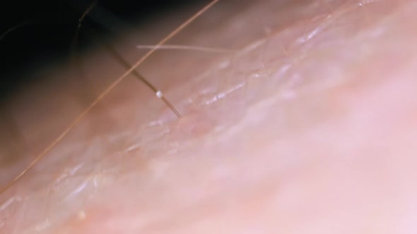 Motion Above Human Skin with Brown Hair on Dark Background alt